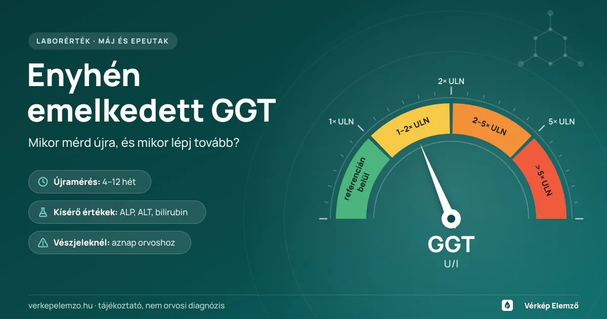 Enyhén emelkedett GGT – újramérés és gondozási küszöbök Félkörös GGT-skála, amelyen a mutató kissé a laboratóriumi felső határ fölött, az enyhén emelkedett sávban áll; mellette az újramérés, a kísérő értékek és az orvosi teendők kulcsszavai